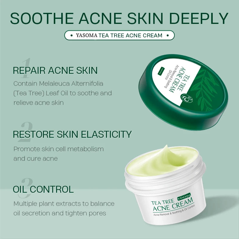 Natural Acne Treatment Oil Extract Facial Cream