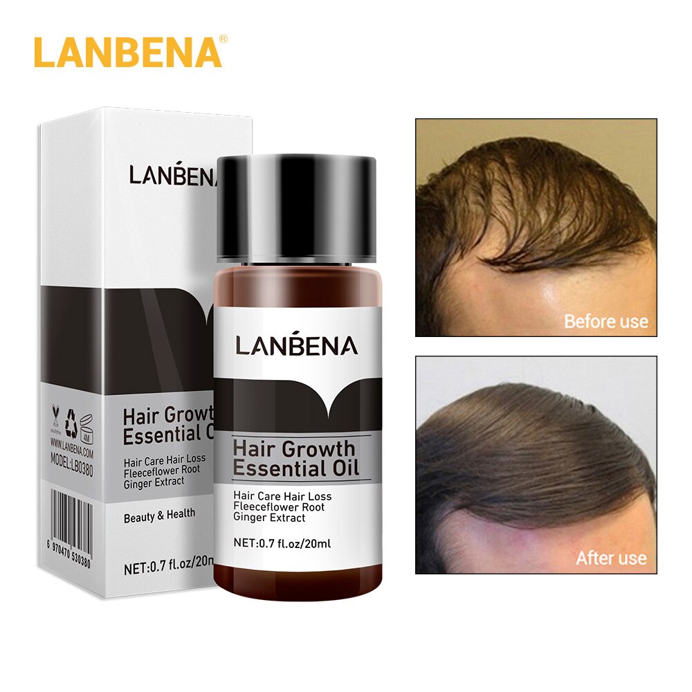 10PCS LANBENA Hair Growth Essence Hair Care