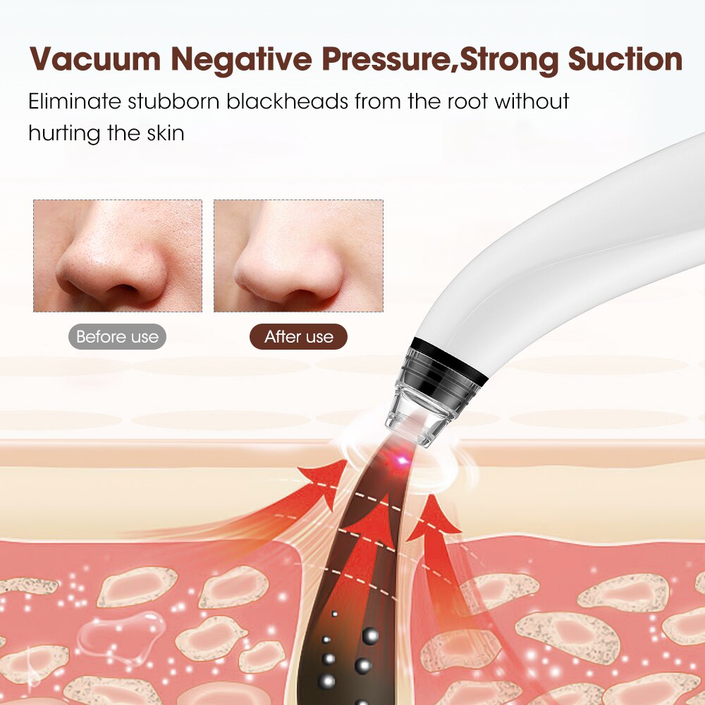 Electric Blackhead Remover with Camera